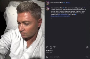 Michael Clarke has skin cancer removed from his nose in latest bout of health struggles - shares photo