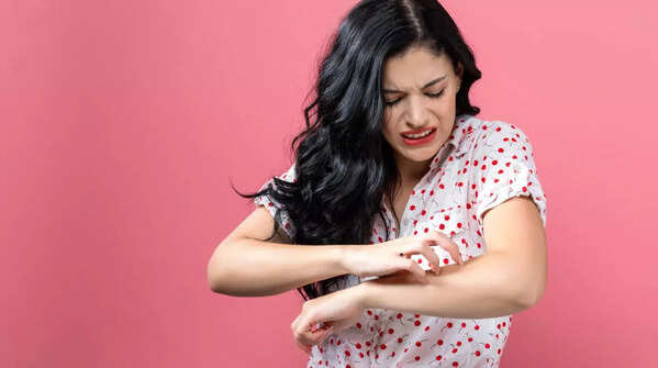 Irregular mole: itchy, painful, or bleeding