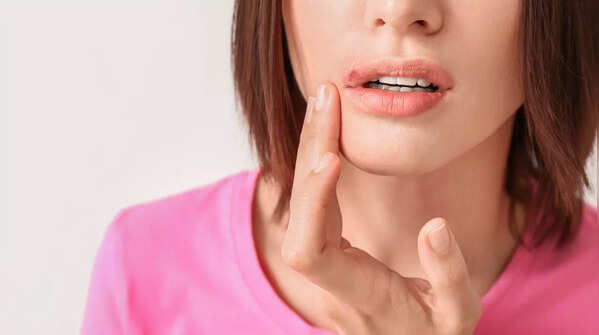 Unhealed wound as a possible skin cancer symptom