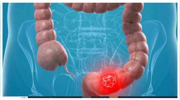 Image representing abdominal discomfort and pain