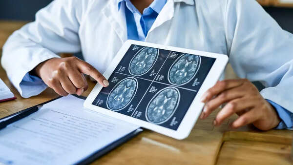 Detailed view of brain activity